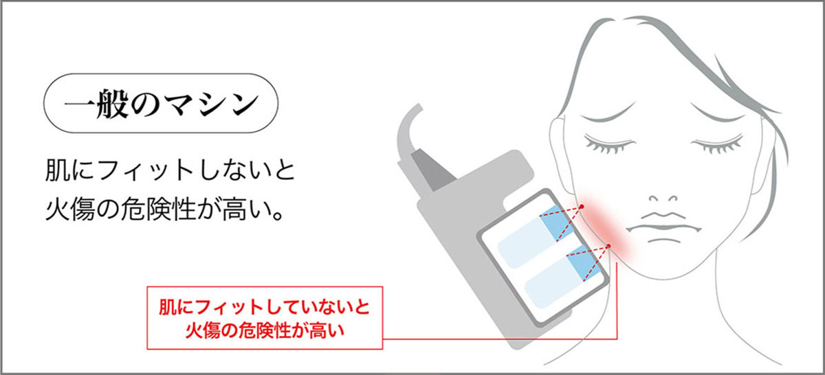 無痛なのに効果が高い理由