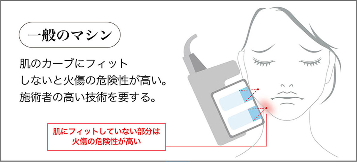 無痛なのに効果が高い理由